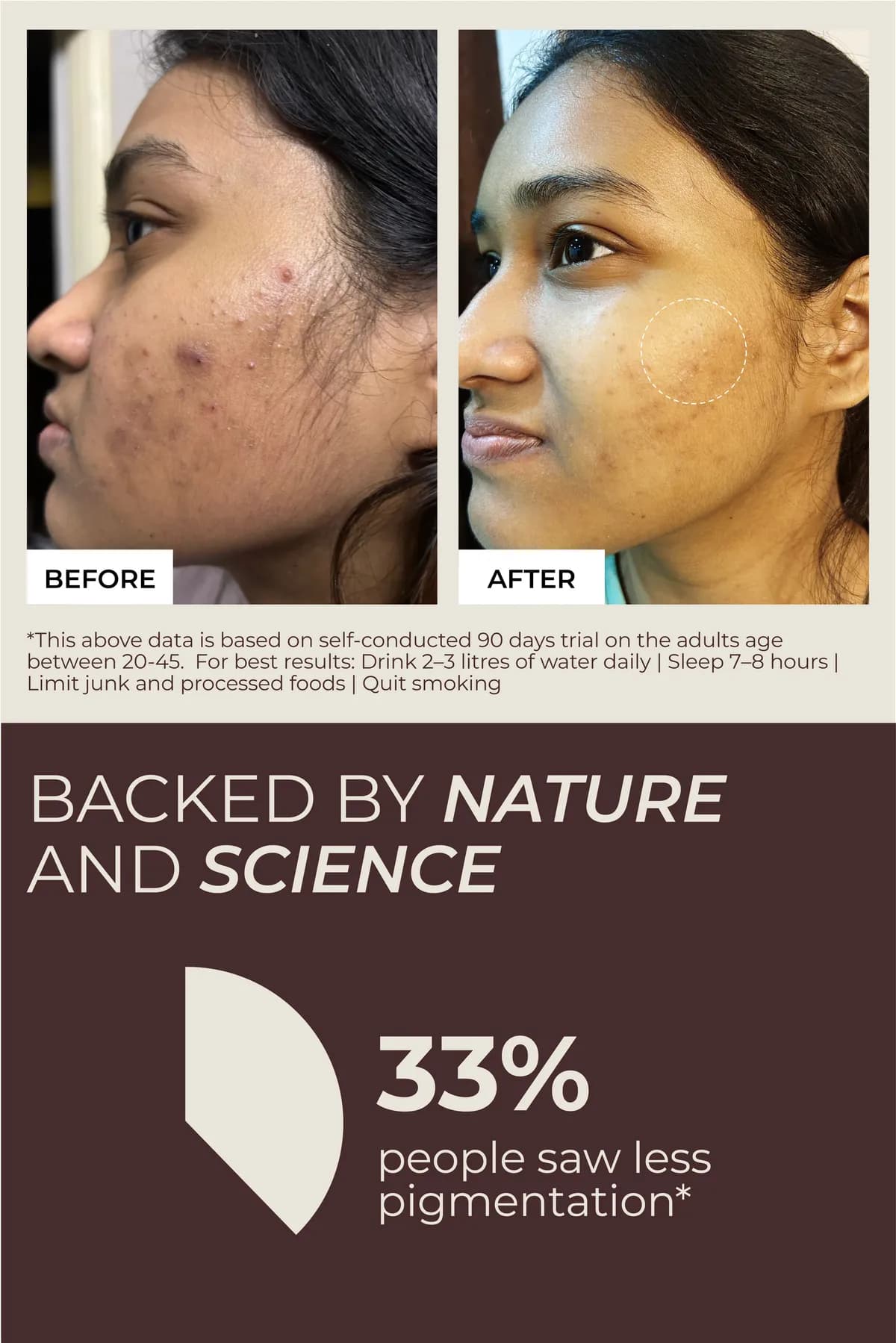 Before and after: 33% of people saw less pigmentation