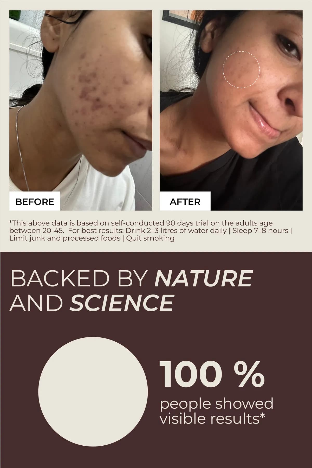 Before and after: 100% of people showed visible results