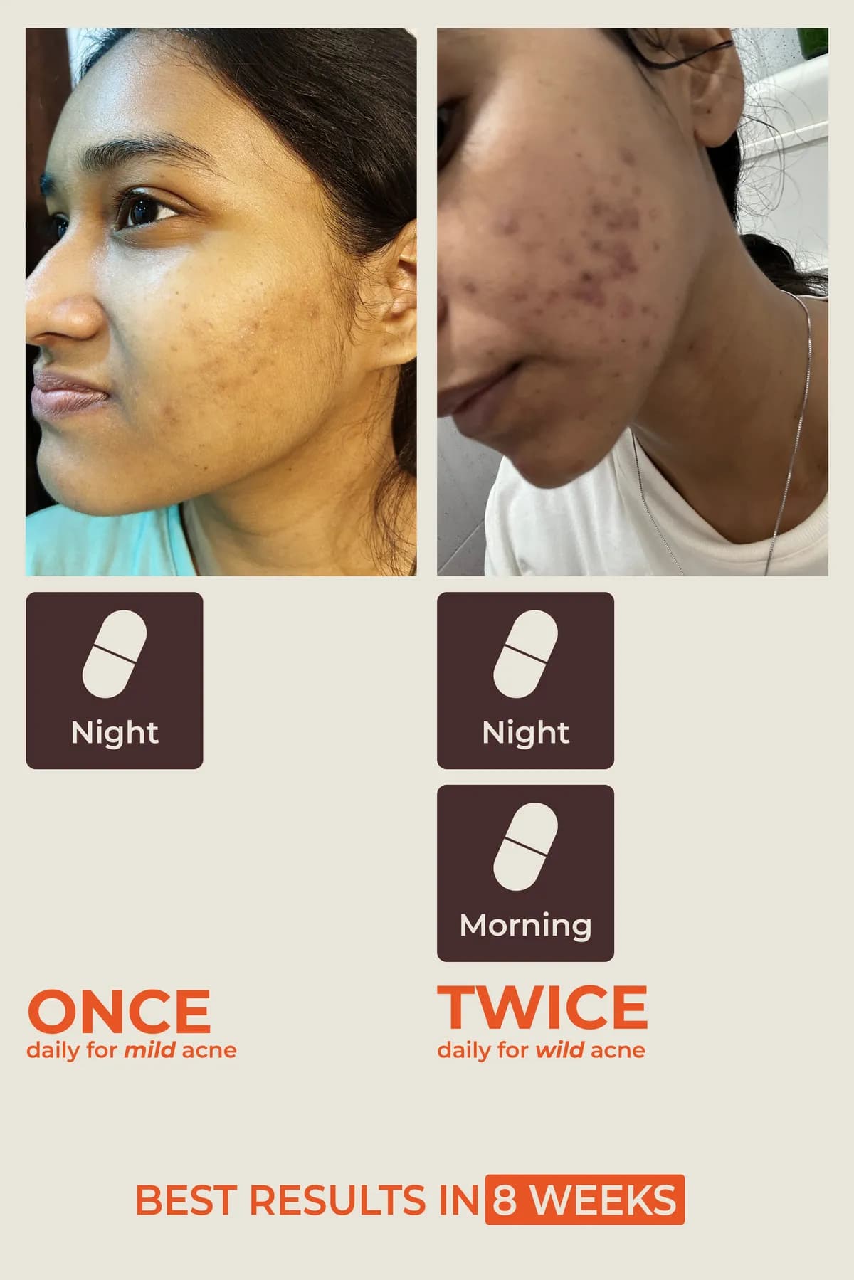 Once daily for mild acne, twice daily (morning and night) for wild acne. Best results in 8 weeks